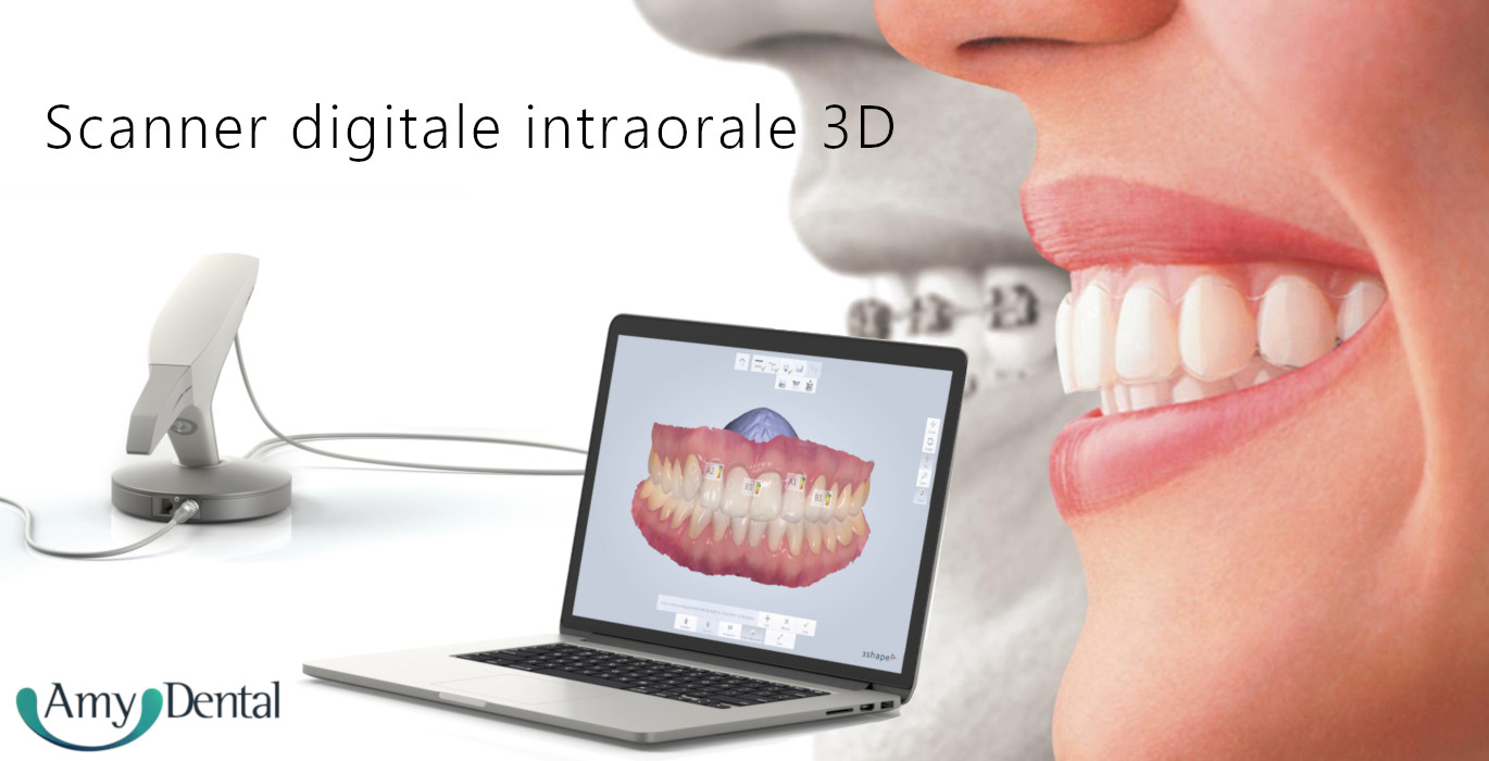 impronta-digitale-intraorale-3D
