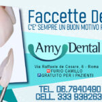 Faccette estetiche a Roma