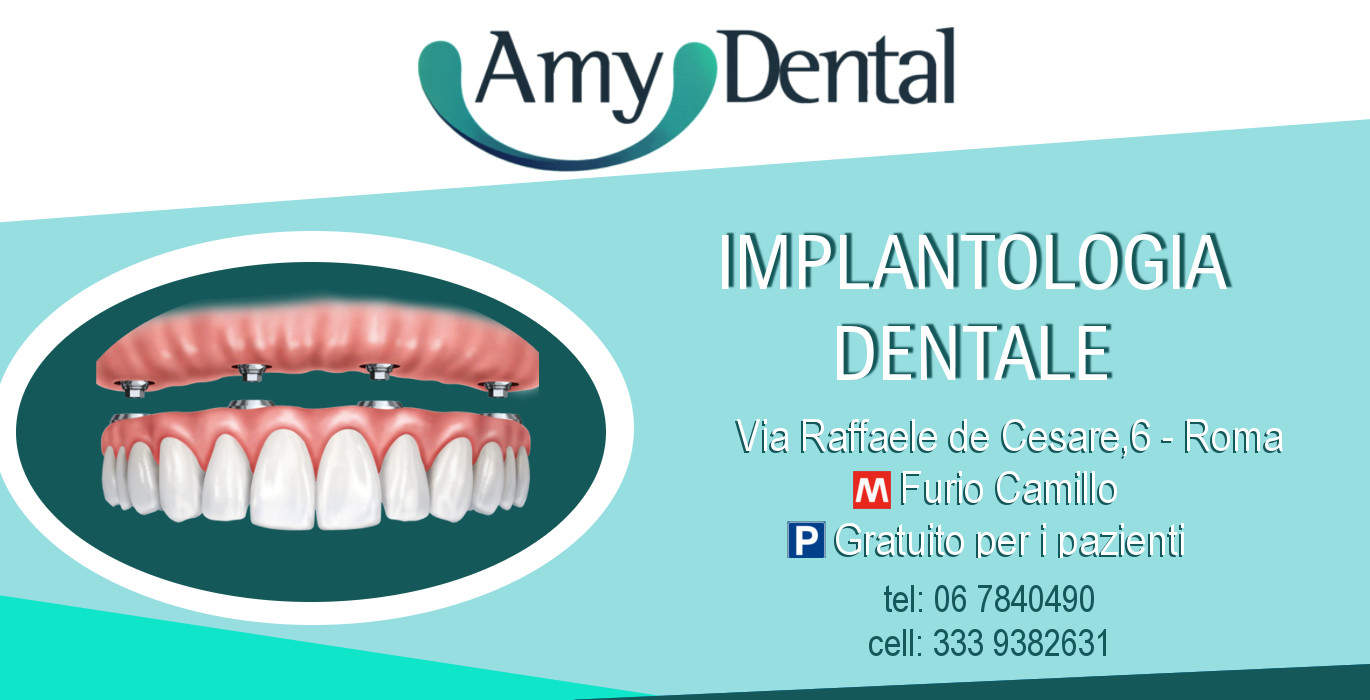 Quanto costa un impianto dentale a Roma