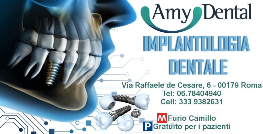 Implantologia dentale a Roma