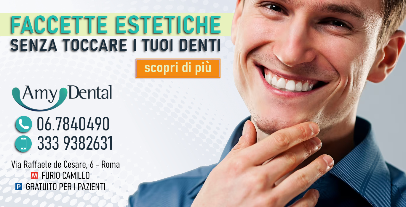 quanto costano le faccette dentali a Roma